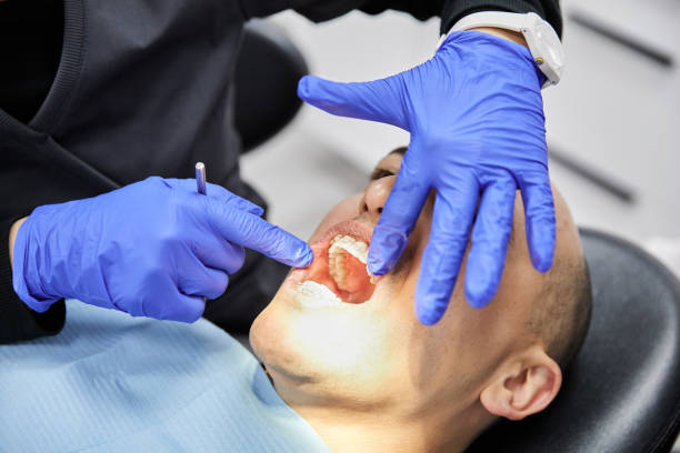 Best Emergency Dentist for Knocked-Out Tooth in Miami, AZ